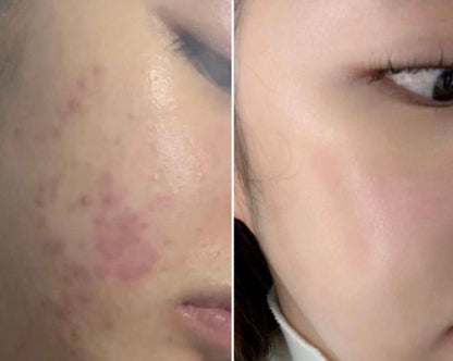 Tónico reparador y calmante. 45% Hongo Sparassis Crispa